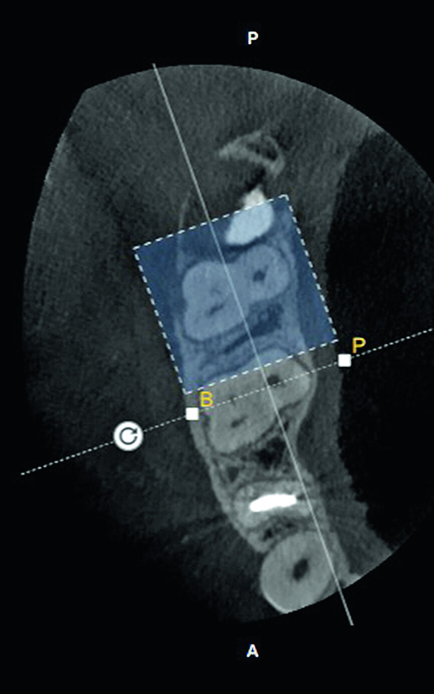 Fig. 5b: Selection of the tooth to be examined.