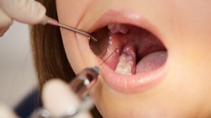 Frustrated with failing local anaesthesia?