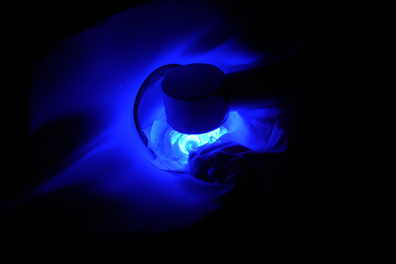 Fig. 18: Light polymerisation through the silicone index.