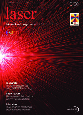 laser international No. 2, 2020