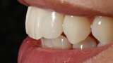 Fig. 15b