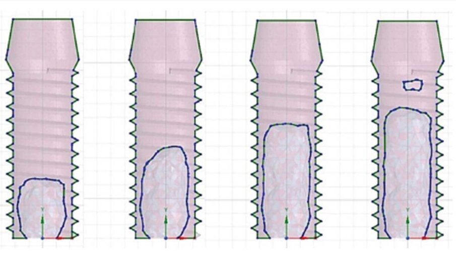 Fig. 15_Esempio di ottimizzazione topologica in cui si va a ridurre il volume dell’impianto.