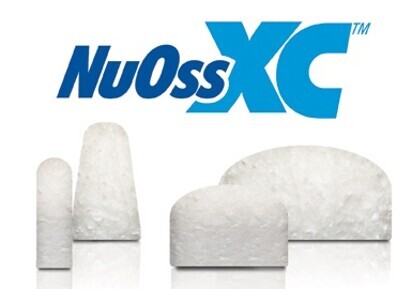 NuOss XC expandable bone grafting composite