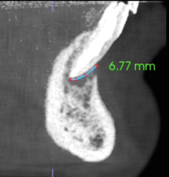 Fig. 6c.