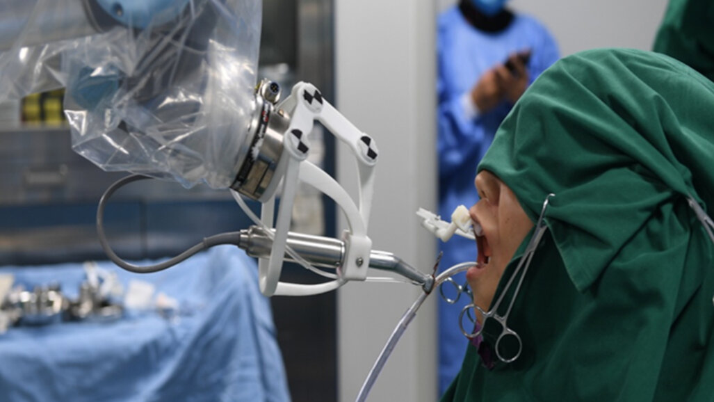 Autonomous robot improves accuracy of socket preparation in tooth autotransplantation