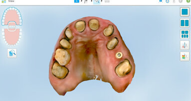 A game-changer in digital restorative dentistry