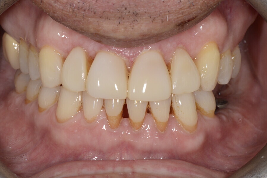 Fig. 20b