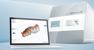 Fabrication and immediate placement of restorations for simple indications in the dental practice