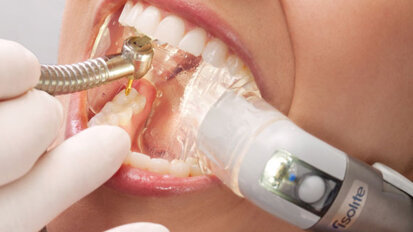 Isolite delivers dental isolation technology