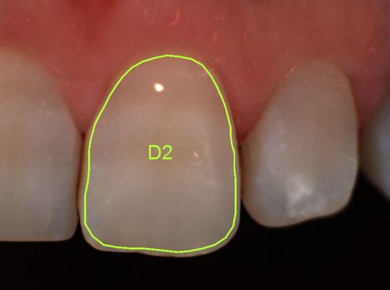 Fig. 3a