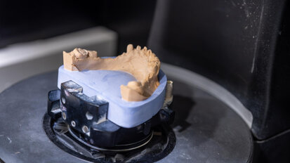 Fast-track smiles: USIM brings digital dentistry to community outreach with 3D-printed dentures