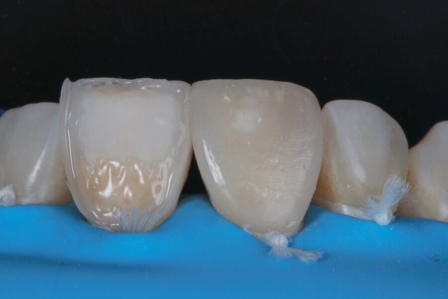 Fig. 5c