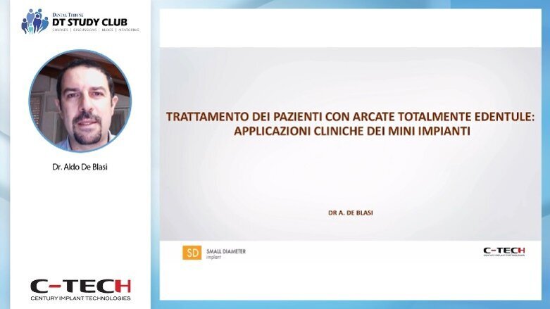 Trattamento dei pazienti con arcate totalmente edentule: applicazioni cliniche dei mini impianti