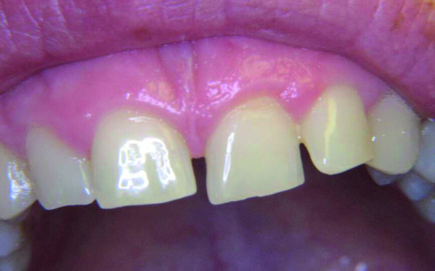 Figure 13
