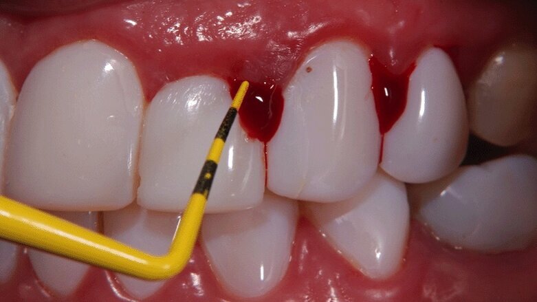 La tecnificación de la odontología
