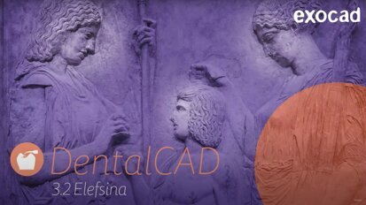 exocad – DentalCAD 3.2 Elefsina Software Release Highlights