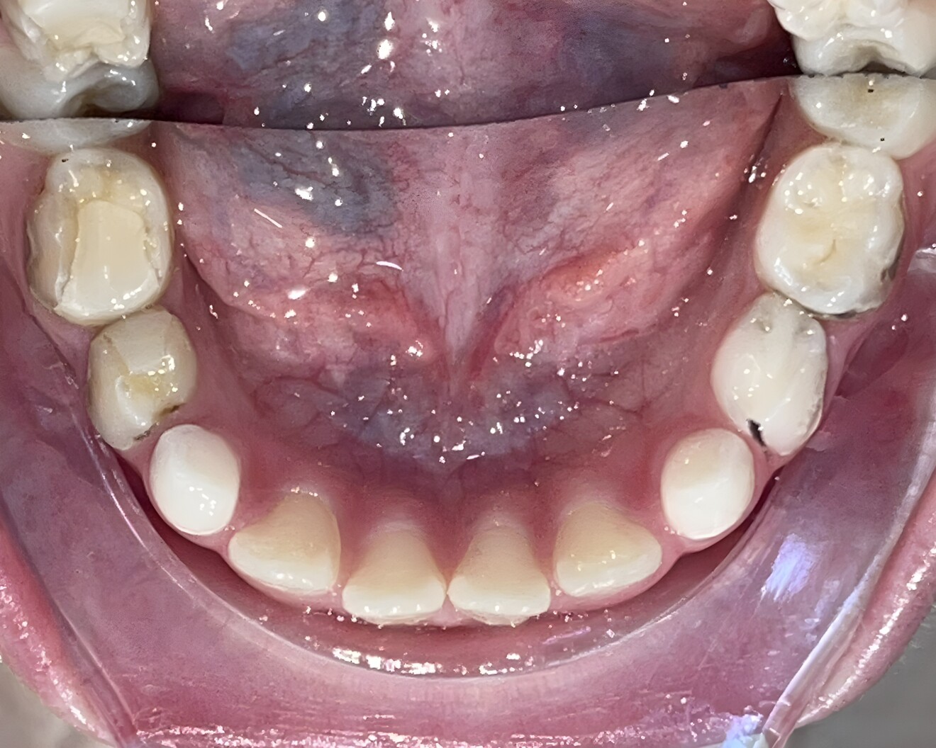 Fig. 1h