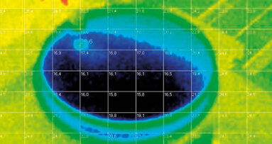 Aspetti biochimici, fisici e clinici del laser nella gestione delle mucositi
