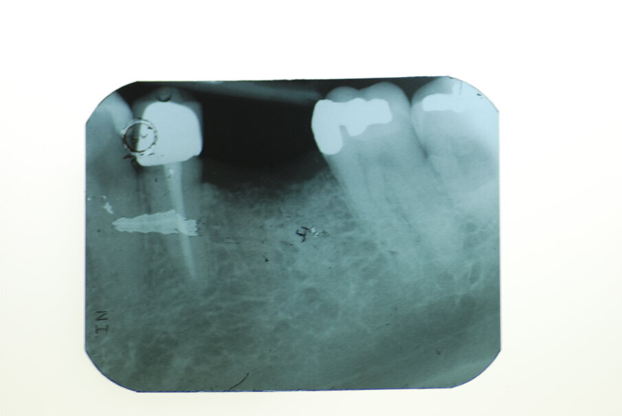Fig. 9