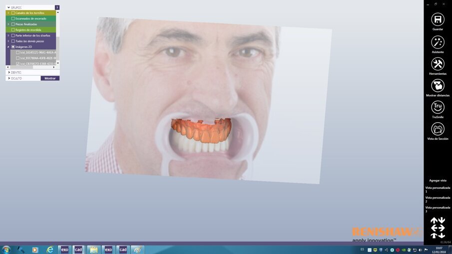 Fig. 1b: Digital mock-up.