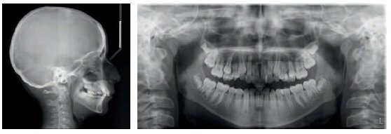 Case01_3