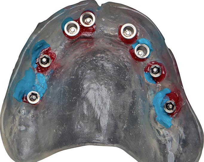 Fig. 25