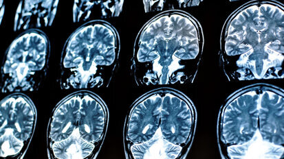 New evidence suggests possible link between brain function and oral health