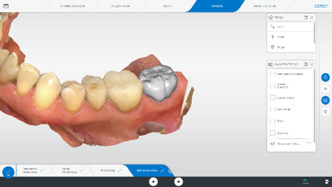 The user interface for designing the restoration, which can be operated via the touch screen