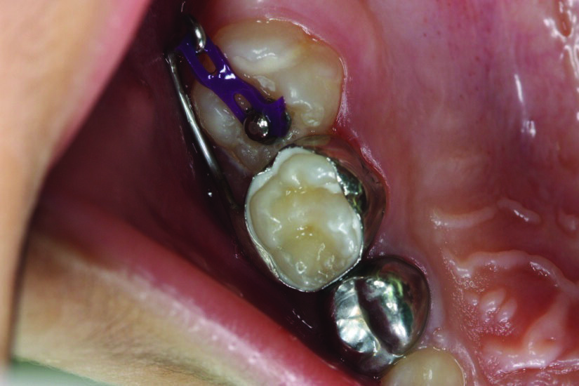 Figure 6a