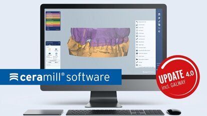 Amann Girrbach optimiert die gesamte Ceramill Software-Familie