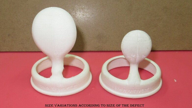 3D Printing: the latest vogue in Dentistry