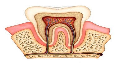 Endodontologen verdeeld over single file-techniek
