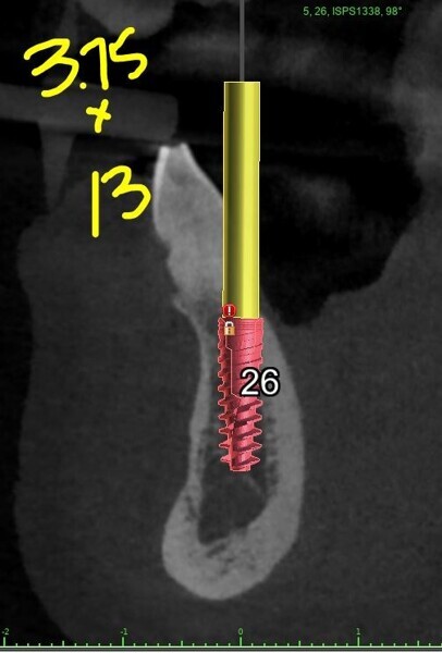Fig. 5b