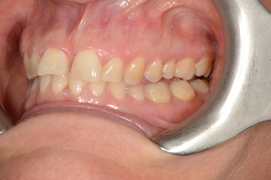 Fig. 3b