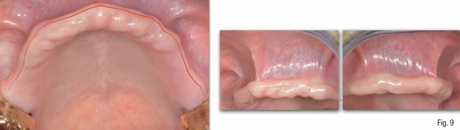 Fig. 9