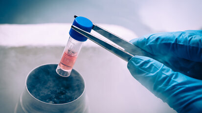 Stem cells from primary teeth may help repair adult teeth, study finds