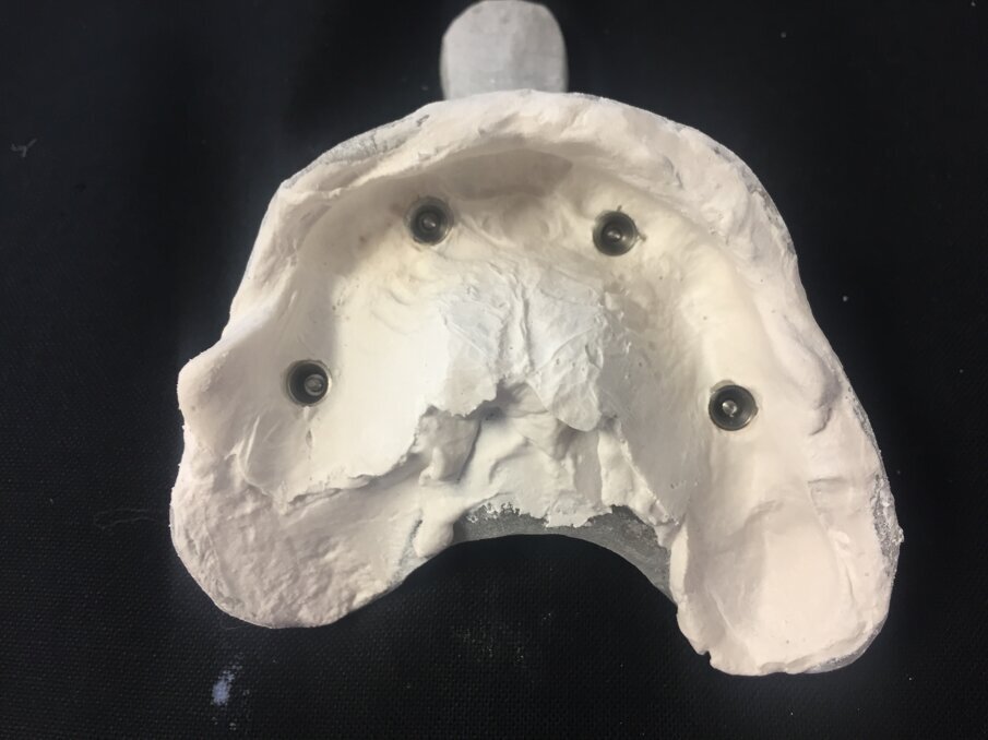 Fig. 27