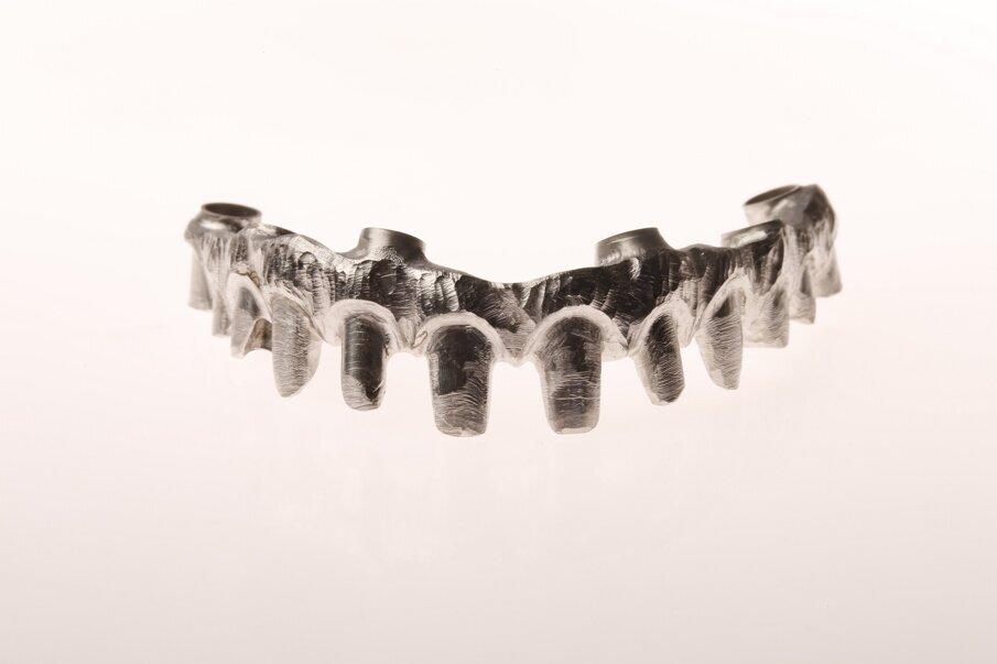 Fig. 6a: Single-crown design on different framework materials for easy repair.