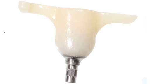 Gingival Cuff Links