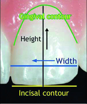 Fig. 3