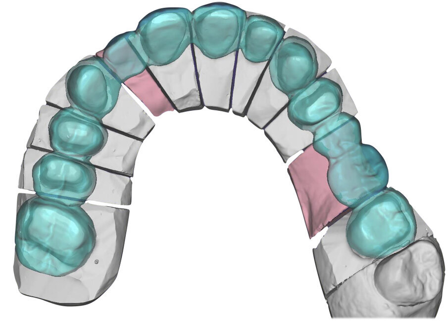 Fig. 51