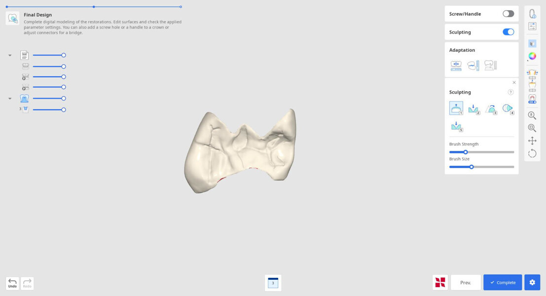 Fig. 9: Virtual restoration without the virtual model in the planning software.