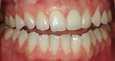 Occlusion principles for the practising dentist in the digital age