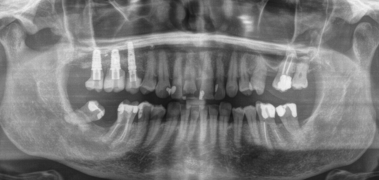 Fig. 34
