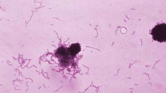 Científicos chilenos afirman haber descubierto una molécula anticaries