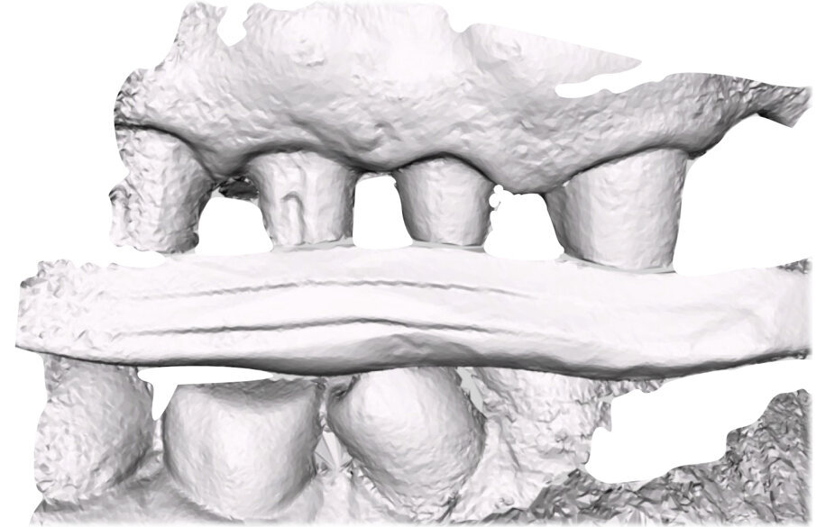 Fig. 15