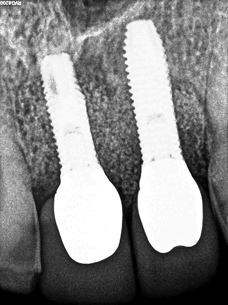 Fig. 9