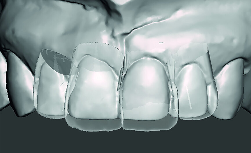 Fig. 10i