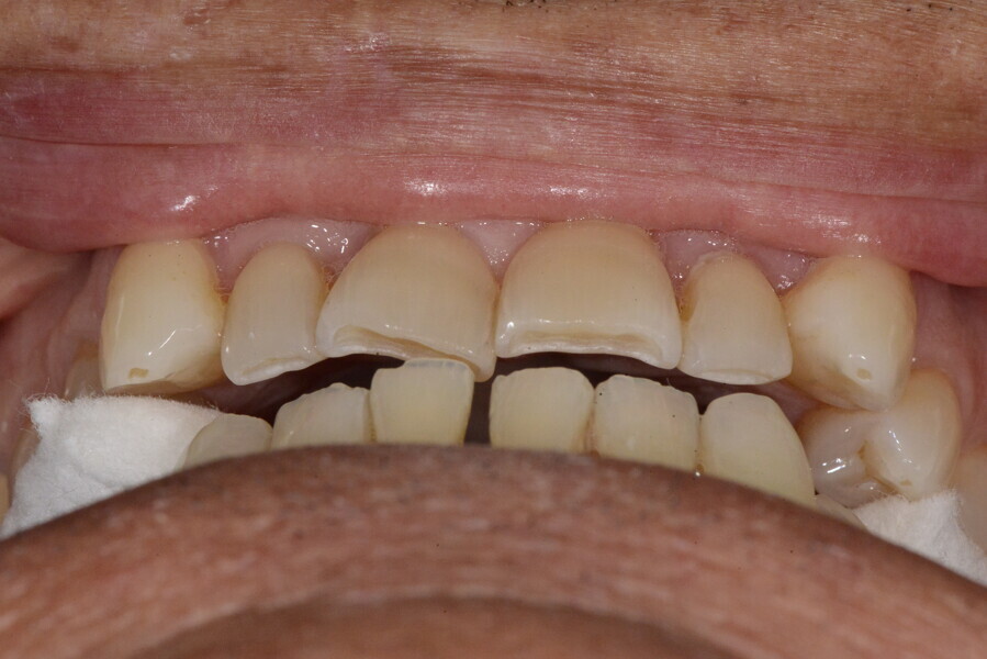Fig. 14b