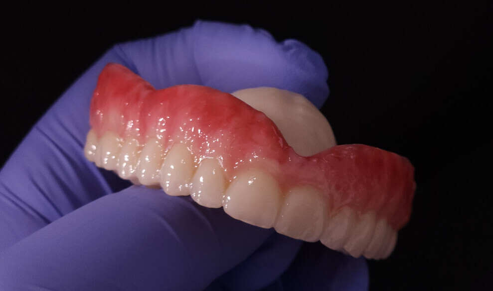 Tools like intra-oral scanners, 3D printers and milling machines allow for a faster and more efficient production of high-quality restorations. 